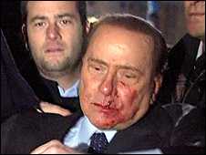 Attacked Berlusconi says ‘love will overcome hate’