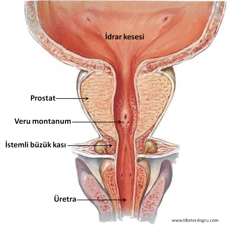 Prostat kanseri